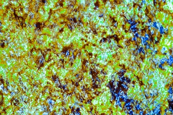 AP 174A1